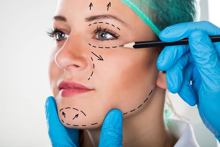 facelift for wrinkles