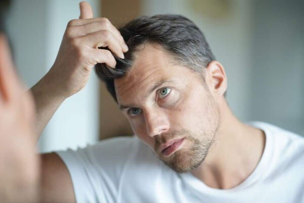 a man worried about hair loss