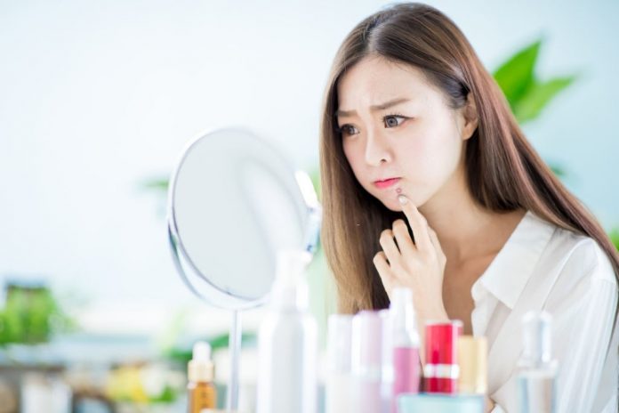 how to get rid of whiteheads around lips how to get rid of whiteheads around lips