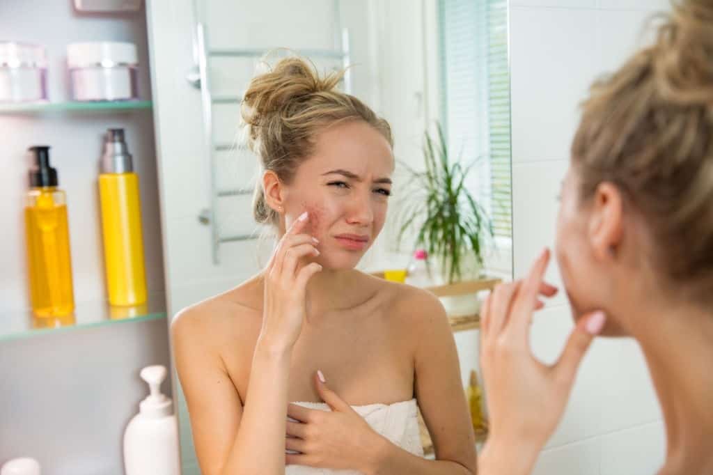 dry skin on face after shower