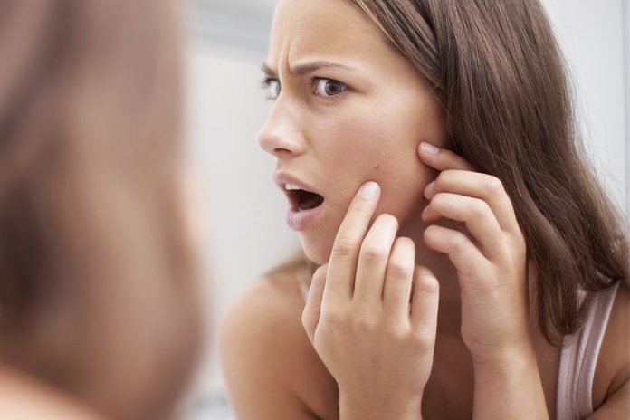 hole from pimple how to heal it hole from pimple how to heal it