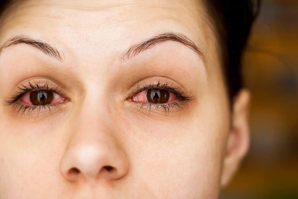 how to disinfect mascara after pink eye