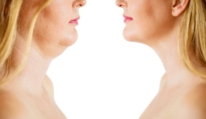 loose skin under chin without surgery loose skin under chin without surgery