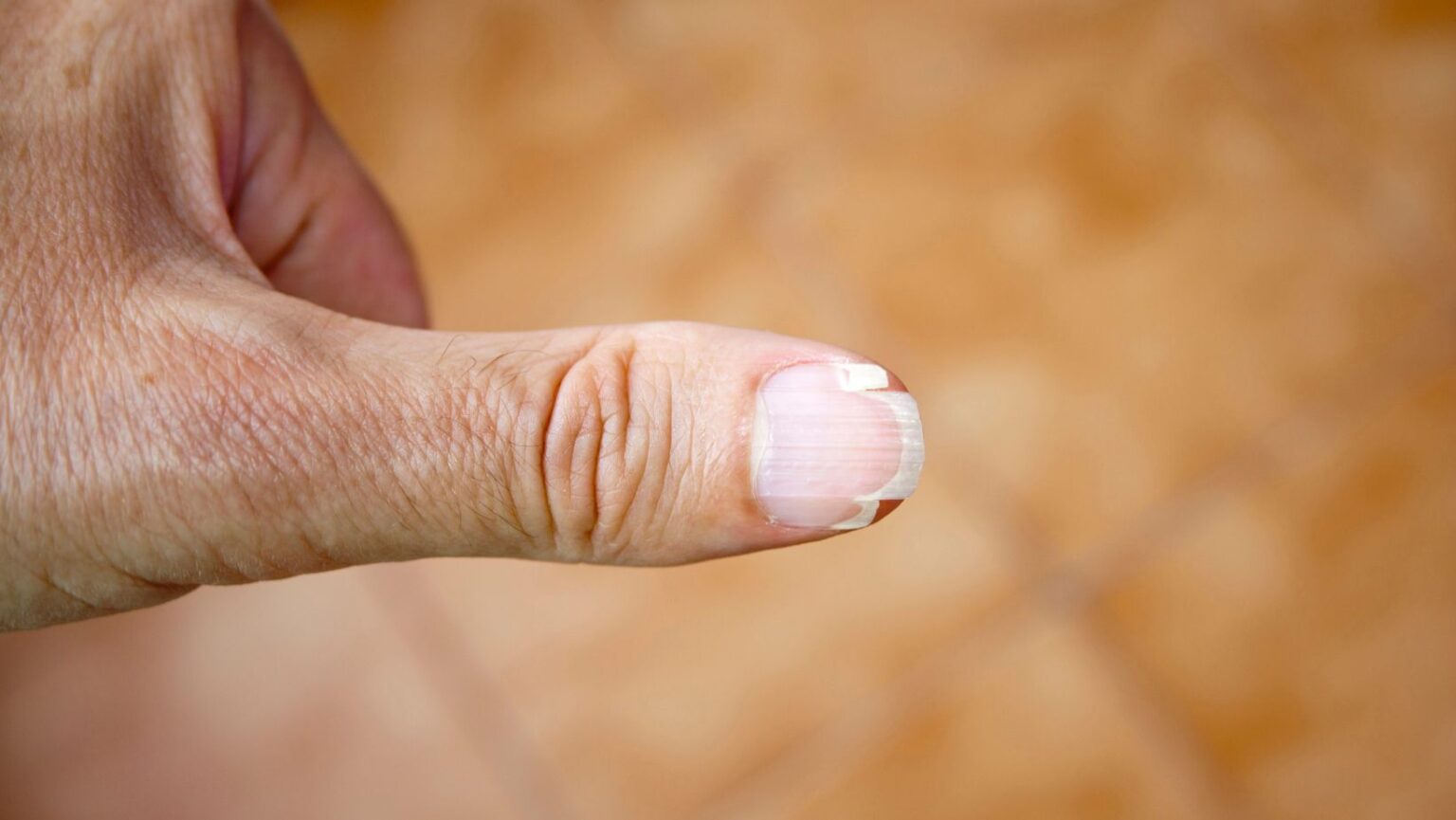 My Fingernails Keep Splitting 8 Reasons and 7 Tips