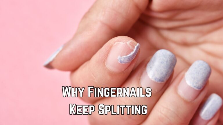 My Fingernails Keep Splitting: 8 Reasons and 7 Tips
