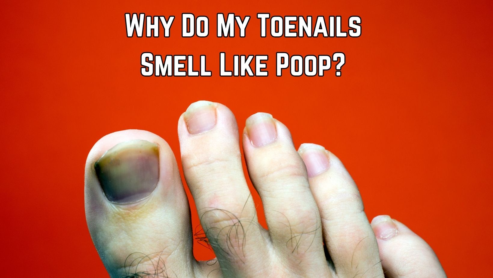 Why Do My Toenails Smell Like Poop